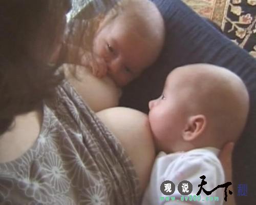 双胞胎女婴生下就有门牙 妈妈说喂奶时不痛
