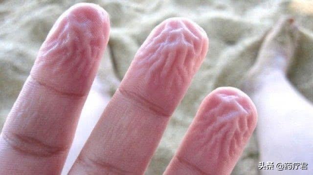 为啥手指长时间泡水会变皱？是身体在暗示什么吗？