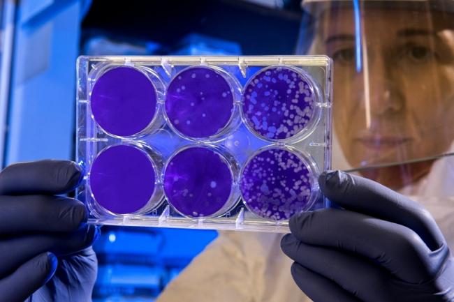 立大功！美加科学家发现全新抗生素，专门消灭超级“致命耐药菌”
