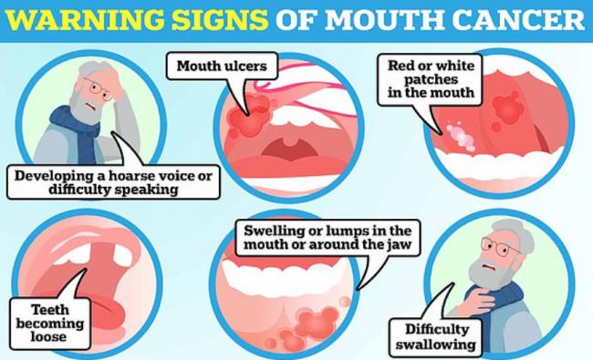 加拿大男子牙痛一查竟是癌症 被告知只能活6年